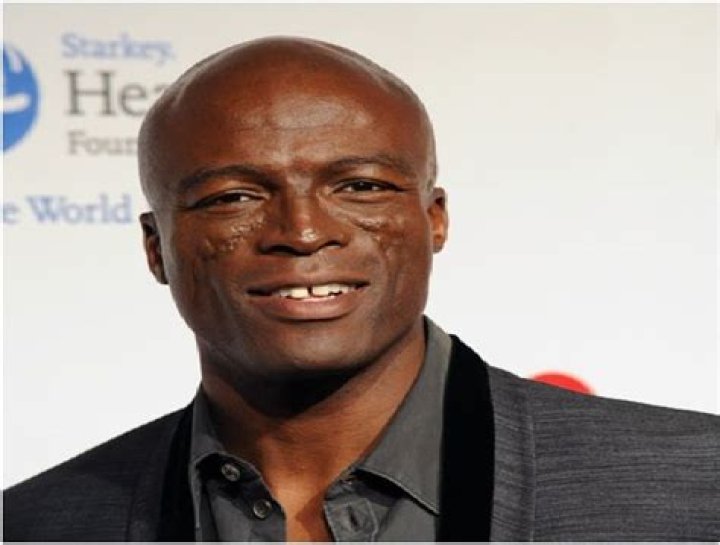 12 Celebrities With Scars And Deformities