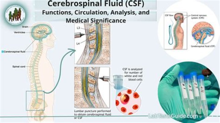 A Comprehensive Examination Of Sinovial Fluid: Anatomy, Composition, And Clinical Significance