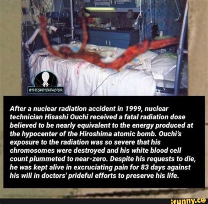 After a nuclear radiation accident in 1999, nuclear technician Hisashi