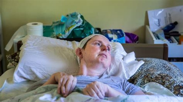 AI Helps a Stroke Patient Speak Again, a Milestone for Tech and