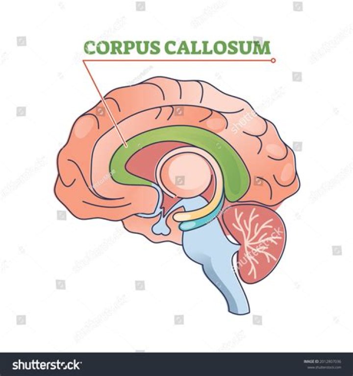 Corpus callosum Function and disorders Medical News Today Prenatal