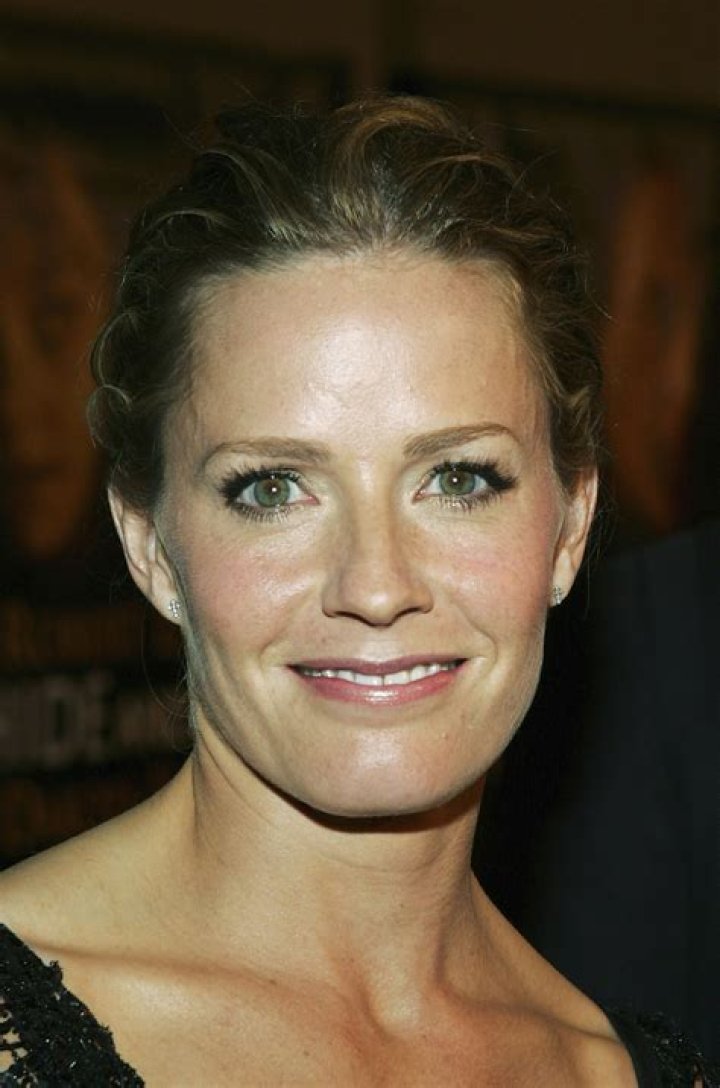 Elizabeth Shue Elisabeth Shue, Laugh Lines, Under The Knife, Beautiful