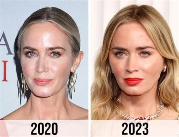 Emily Blunt Before and After From 2004 to 2024 The Skincare Edit