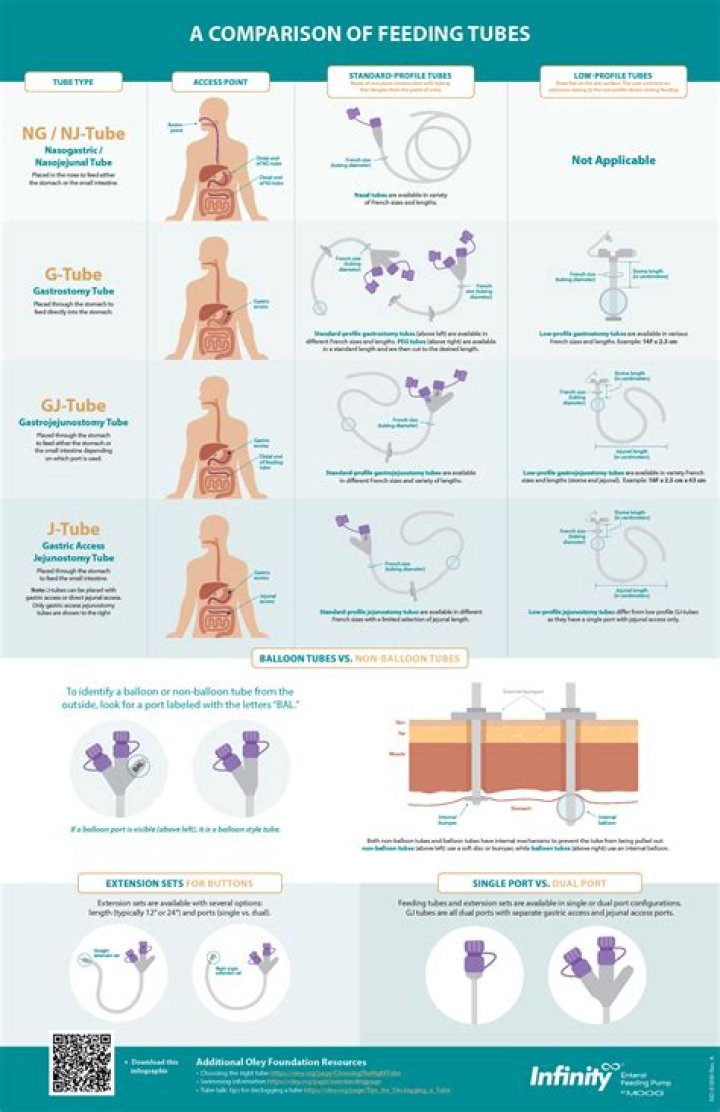 Essential Guide To Dobhoff Tube Placement: Procedure, Benefits, And Risks