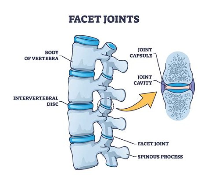 Facet Joint & Bone Treatment, South Plainfield, NJ BCT Medical