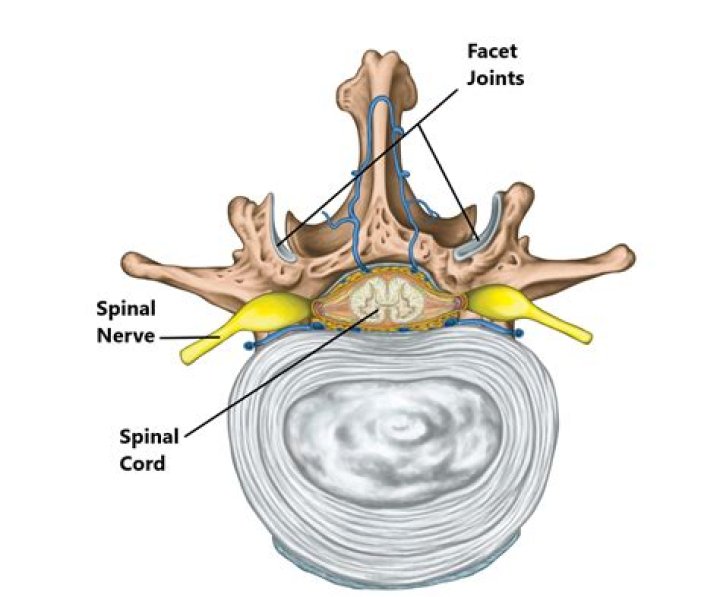 Facet Joint Injuries My Family Physio