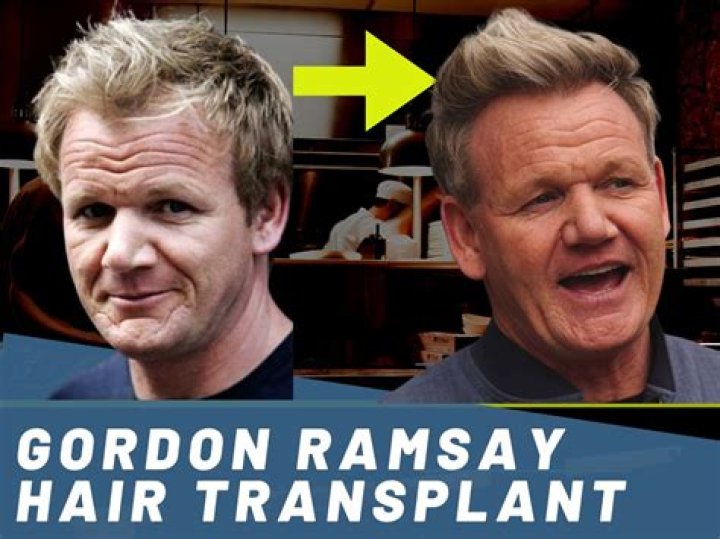 Gordon Ramsay sparks new hair transplant rumours with questionable hairstyle Daily Mail Online