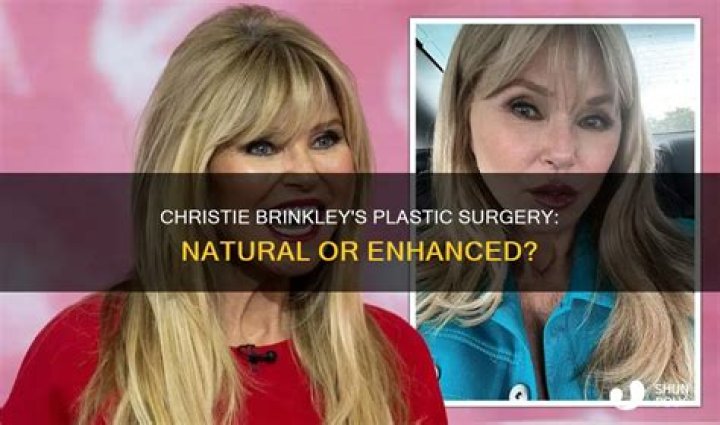 Has Christie Brinkley Had Plastic Surgery? See Her Transformation