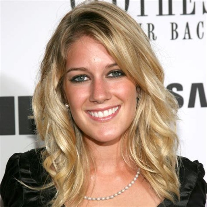 Heidi Montag Plastic Surgery Photos of Her Before and After