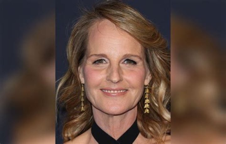 Helen Unrecognizable After Plastic Surgery Makeover, Top Docs Claim