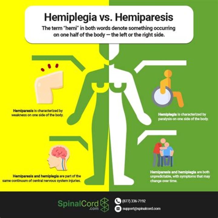 Hemiplegia vs Hemiparesis Causes, Symptoms, and Treatment