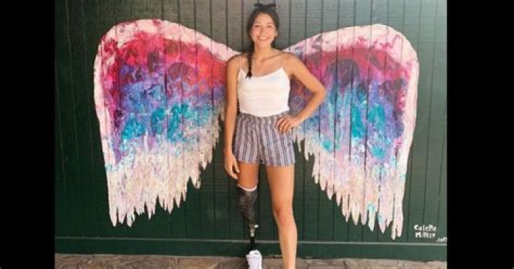 How did Alaqua Cox lose her leg? Marvel's 'Echo' star triumphs over