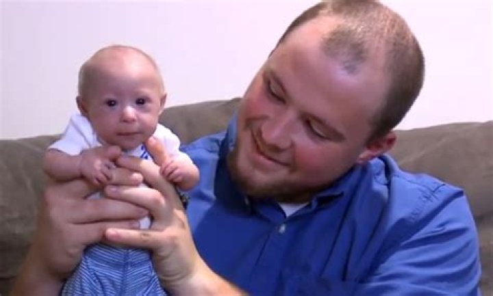 Kentucky baby born with rare form of dwarfism
