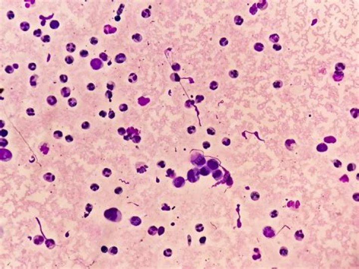 LIQUIDO SINOVIAL Inflamaci&oacute;n Citocina