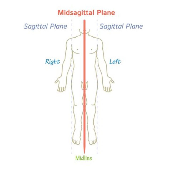 Midsagittal Plane