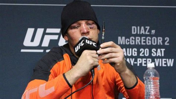 Nate Diaz accepts public warning for vaping at UFC 202 postfight news conference