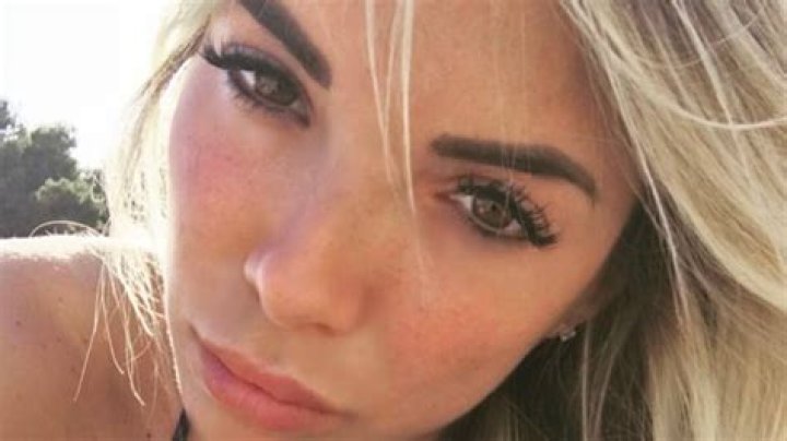 Noemi Bocchi soffro di diastasi addominale. Il sostegno di Totti iO