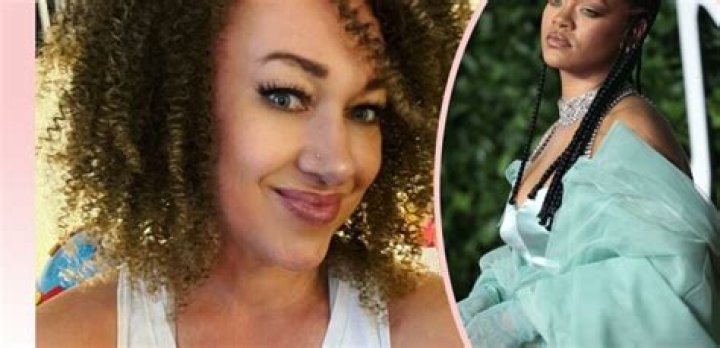OMG, Rachel Dolezal Has An OnlyFans, The Photos Leaked, & She Speaks In