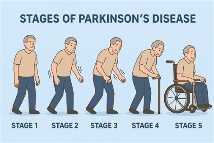 Parkinson's Disease London Neurosurgery Partnership