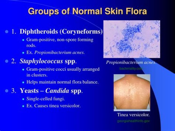 PPT Normal and Transient Flora; Host/Parasite Relationships
