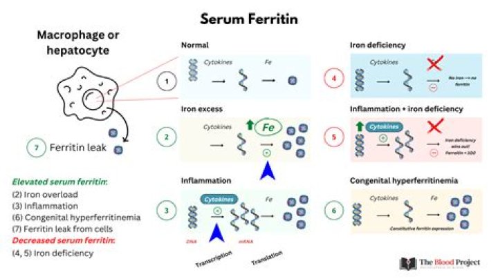 RACGP Elevated serum ferritin what should GPs know?