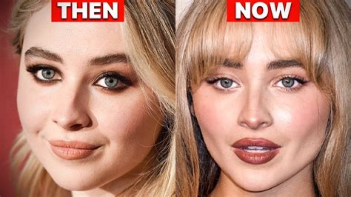 Sabrina Carpenter's Lip Injections: The Truth Revealed