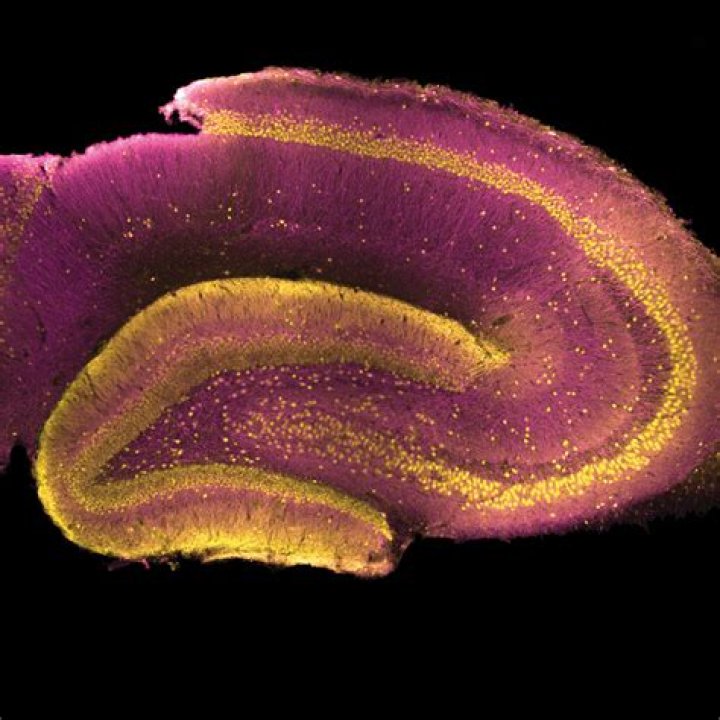 Scientists reveal where schizophrenia may ori EurekAlert!