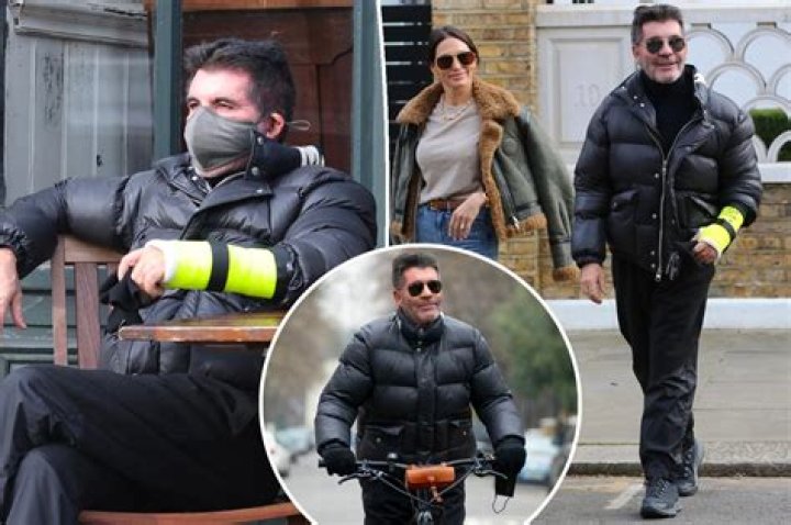 Simon Cowell lost a tooth the same week as recent bike accident