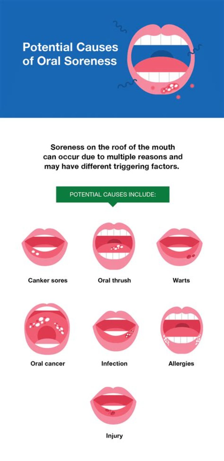 Sore Roof of Mouth Causes & Treatment SmartMouth