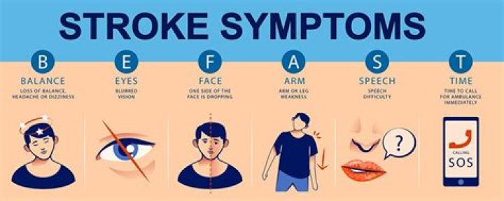 Stroke Causes, symptoms and treatment