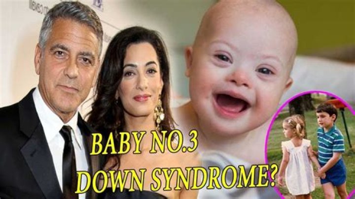 The Journey Of Clooney's Twins With Down Syndrome Love