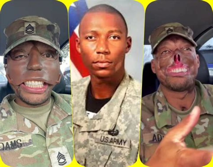 What Happened To Randy Adams Army