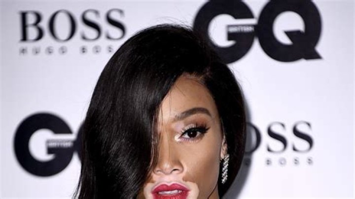 Winnie Harlow hair best celebrity hairstyles & beauty 2017 Glamour UK
